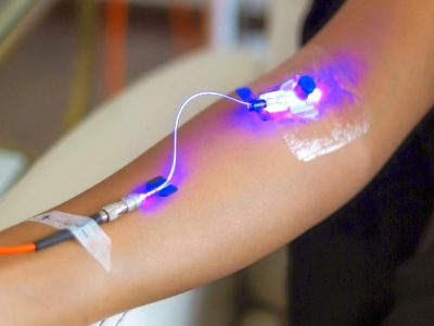 Weber-Laser-IV-Therapy